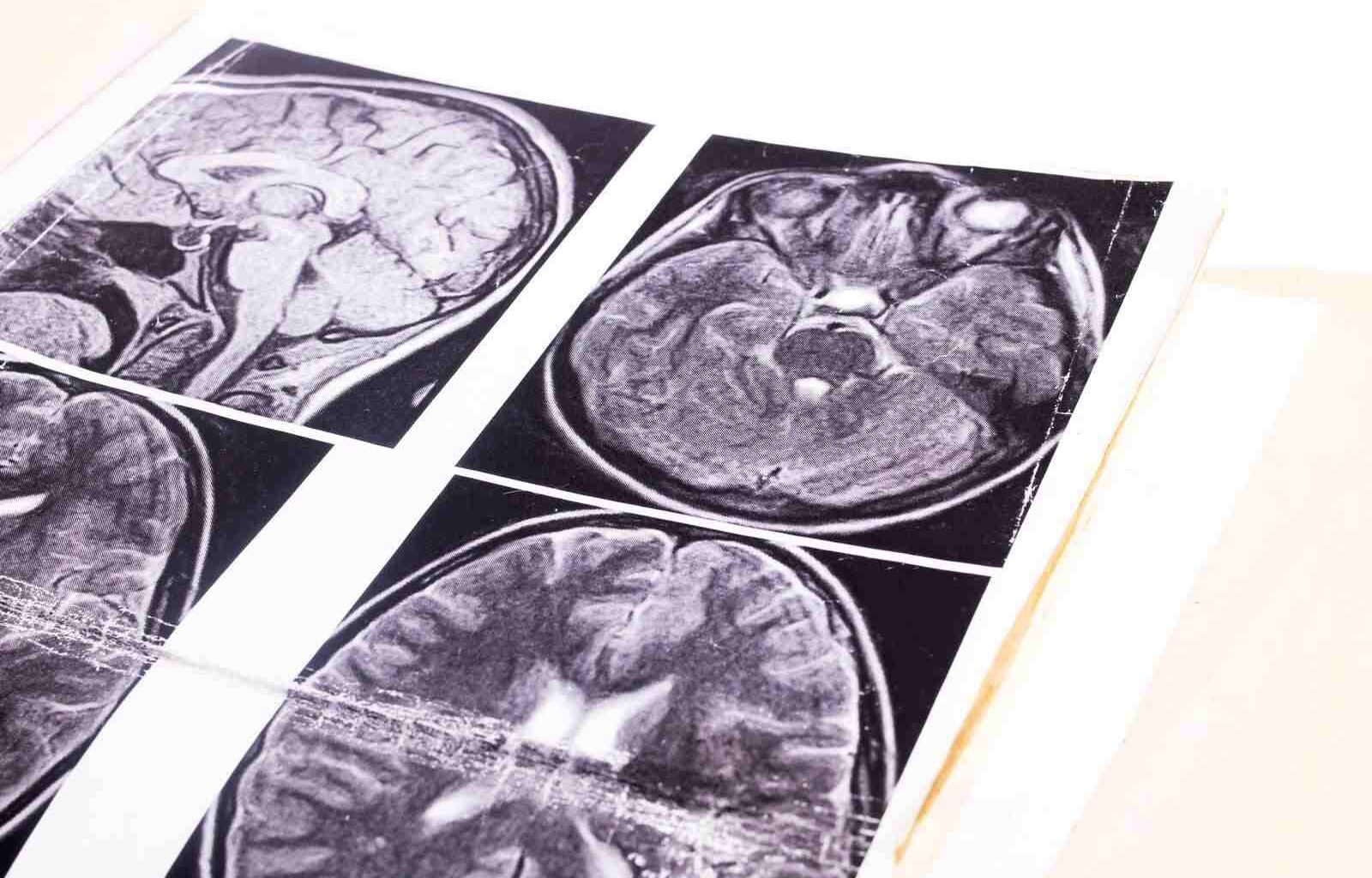 brain medic image