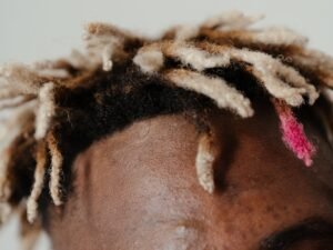 can nootropics lead to acne